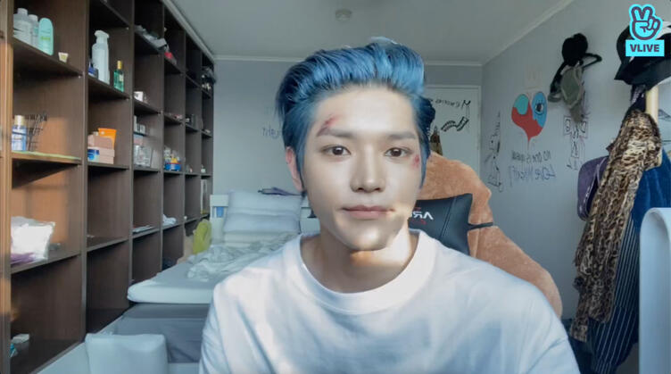 📂📌 20200607 계단에서 잠깐 굴렀을뿐이에요 💚💚